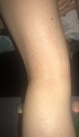 Skin Joint Arm Human leg Leg