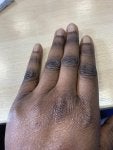 Finger Skin Hand Nail Joint