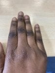 Finger Hand Skin Nail Joint